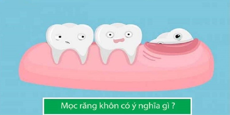 Mơ mọc răng khôn ở em bé mang ý nghĩa gì